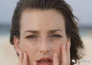 脸发黄脸的照片,照片中的健康信号