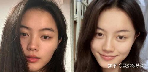 脸发黄脸的照片,照片中的健康信号 第3张 脸发黄脸的照片,照片中的健康信号 第3张