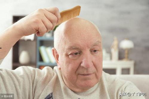 脱发好处搞笑  第2张