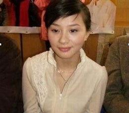 郝蕾整容前后照片,美丽蜕变，岁月如歌